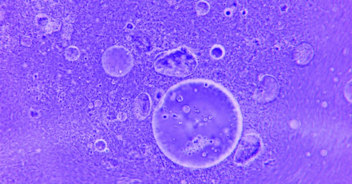 Excel INDIRECT: Create Dynamic Cell References Without the Headache